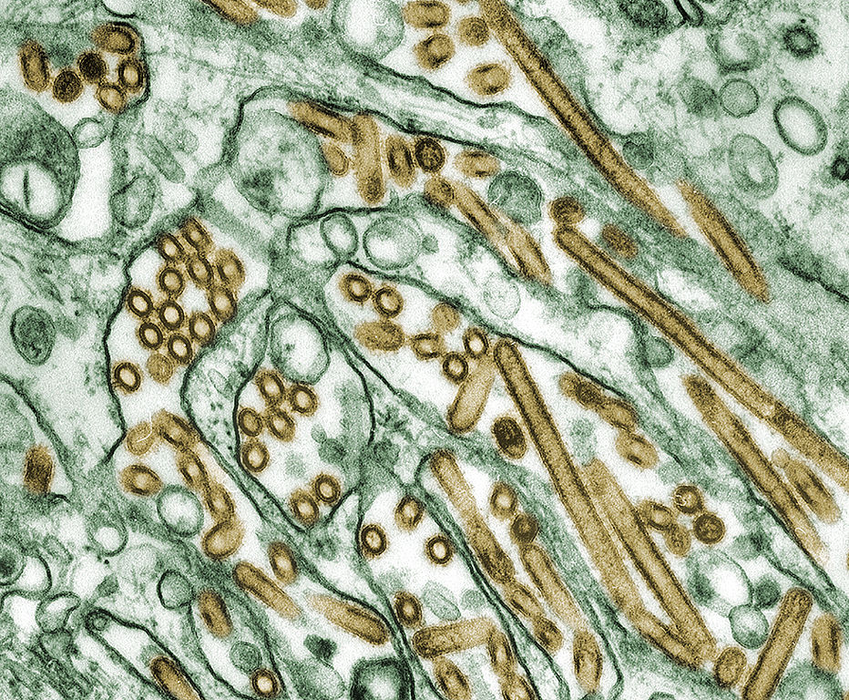 A colorized transmission electron microscopic (TEM) image of avian influenza A H5N1 viruses (seen in gold) grown in MDCK cells (seen in green).When these viruses infect humans, the signs and symptoms include fever, cough, sore throat, muscle aches, diarrhea, and severe respiratory disease. Cynthia Goldsmith/CDC