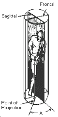 Figure VII:1-2. Measure of Asymmetry Angle A