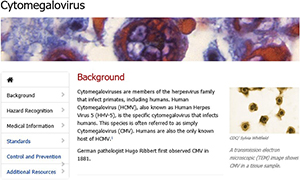 Screenshot of OSHA Cytomegalovirus page